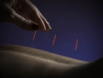 Acupuncture spa treatment at Sun Valley Idaho Kevin Syms Photography for Hotels and Resortsresort Spa